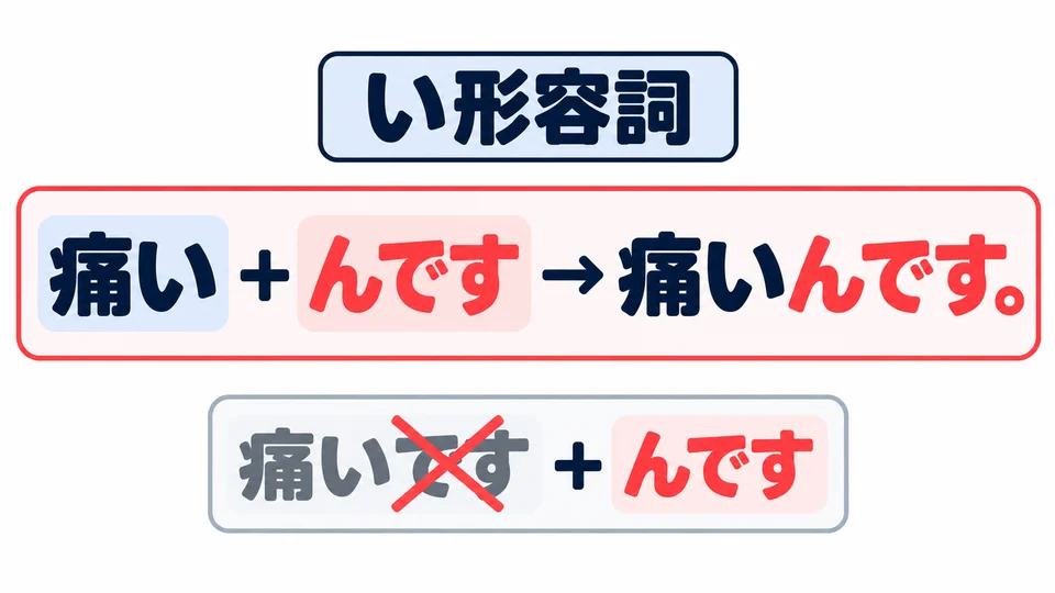 Attach 「んです」 directly to an い-adjective: 痛い＋んです. Do not keep the final です.
